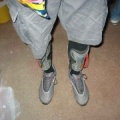 cyborgfeet